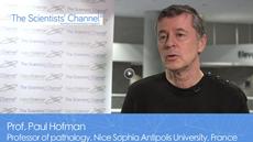 Evaluating Tumor Mutational Burden with NGS